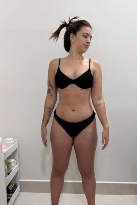 Gra depois de eliminar 15 kg